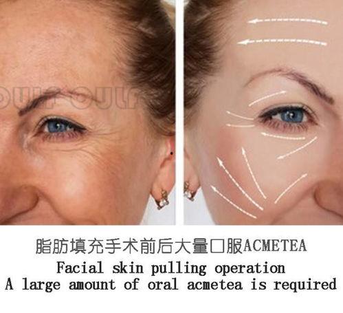 脸部缝针后吃矮瓜行吗